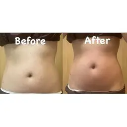 【即効性!腕or腹or腰】指定部位7D H I F U10000shot+ハイパーナイフ15分