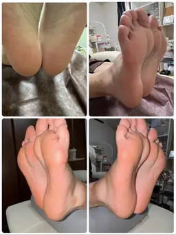 フット角質ケア（フットバス無し）