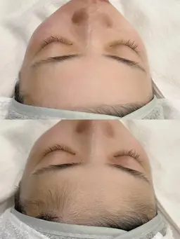 お肌のムダ毛・産毛さようなら👋🏼 ウルツヤモチで最高にモテ肌が手に入ります🧖🏼‍♀️♡見えない産毛までゴッソリ！