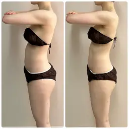 痩身メニュー💖 全身デトックス🔥 酵素浴＋ハイパーナイフEX全身 【モニター限定3名様】⚠️口コミ必須