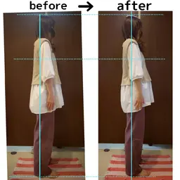 【男性女性】キネセラ＋小顔マッサージ(顔首頭)