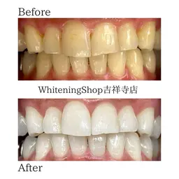 【✨口コミ記載の方78%OFF！✨】お試し 照射パワー100%！たっぷり45分間照射‼️