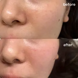 艶肌が叶うフェイシャルWAX