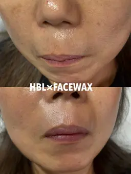 Sパーツワックス(おでこ、頬、鼻毛、口周り)この中から１箇所のみ