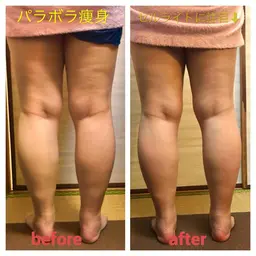 パラボラ痩身(両脚)