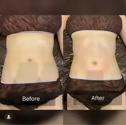 痩身エステ〔お得な選べる1部位〕