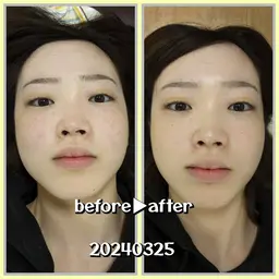 【レディース⠀】フェイシャル CS60 骨膜筋膜にアプローチ 小顔、むくみに○