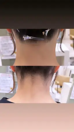 《 うなじ脱毛+デザイン🪒 》