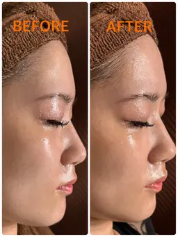 フェイシャルエステ通常コース💆✨