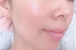 基本のフェイシャル+お肌ちゅるん♪ピーリング