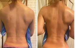 部位別 痩身エステ 各部位 ☆背中 +脚ヒッ¥4000or+お腹¥3000