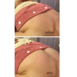 【NEW 】バストケア👙✨