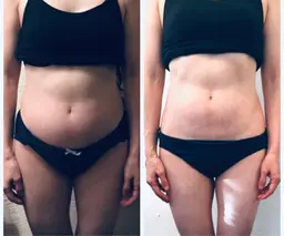 掲載キャンペーン🎉モニター募集❣️痩身 くびれ 美脚 美尻 背中痩せ 💎骨格美痩身60分💎