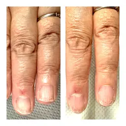 究極のネイルケア