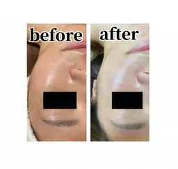 《美白ツヤ肌コース》