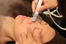 【人気NO.1毛穴洗浄コース】お顔全体の毛穴の汚れ、黒ずみを洗浄します。