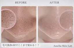 【新生活応援】毛穴洗浄+艶肌Wax(全顔)+鎮静ケア