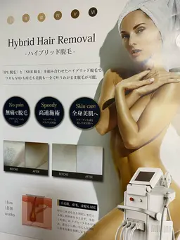 全身脱毛　一般　（顔.V.I.O含む）※初回のみカウンセリングに30分程度お時間いただきます。女性