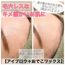 【今月限定🌹】他のメニュー＋部分ワックス脱毛1,100円