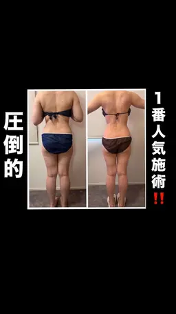 デトックス痩身(全身)60分21,000円→