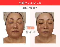 周年記念【小顔】造形マッサージ+背中マッサージ+ツヤ肌パック60分