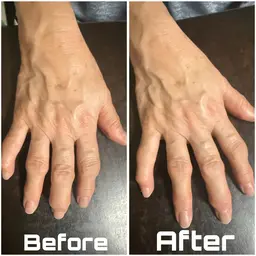 【手元から若々しく✨】スペシャルハンドケア🌿ネイルケア込。EMS×オイルで手のエイジングケア！ツヤのある理想の手元へ