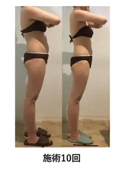 慢性疲労、痩身90分コース