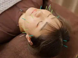 【お顔のお悩みに特化◎】 電気美容鍼