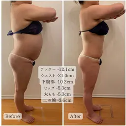 ミニモ限定❗️早く結果を出したい方✨全身すっきり痩せコース＋岩盤浴💕切らない脂肪吸引【整形級ダイエット】🔥
