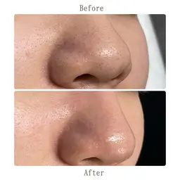 🍋ビタミンC洗顔+毛穴洗浄】⟡.*ザラつきいちご鼻💭ྀིお悩み解決❕