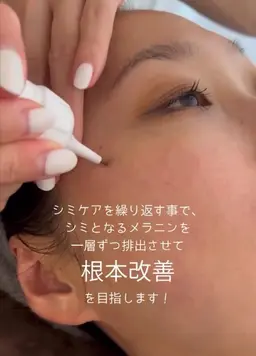 初回価格￥5500⇨￥3000シミケア！！30分当て放題！！