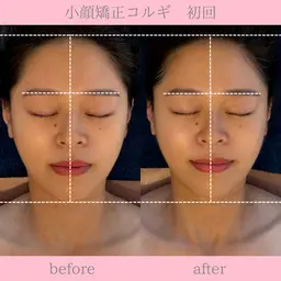 ミニモ限定クーポン✺⋆*小顔矯正コルギ＋上半身マッサージ付🉐顔歪み矯正◎ほうれい線◎