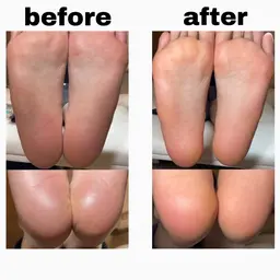 フット💜角質ケア✨角質ケアのみご予約の場合はこちら💕【フットバス付】