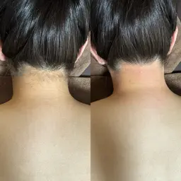 【ブライダル向け】プレ花🆗🌼背中上部シェービング&うなじワックス👰♀️✨ ¥5,400