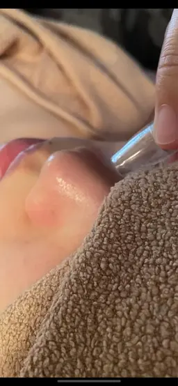 『月曜日限定』毛穴洗浄(祝日の場合翌火曜日対象)