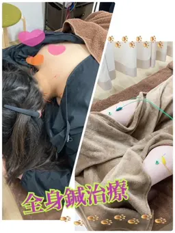 【新規限定】【4月限定価格】🌸全身鍼（慢性痛・女性特有の悩み）（＋500円で箱灸追加可能✨）