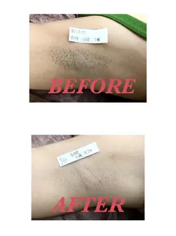 【両わき】🔰脱毛モニター募集中🔰3回2,700円❤脱毛の定番箇所🎵