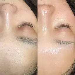 ［モニター限定📸］特別クーポン🌼minimo限定🩷フェイシャル脱毛ワックス×産毛や角質除去 ✨即日効果あり⭕️