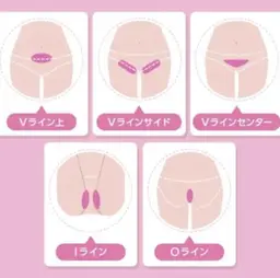 ⛄️VIO美肌脱毛⛄️冷却機能・デザイン自由👌本気で毛をなくしたい方必見💍目指せ自己処理いらず肌🌟