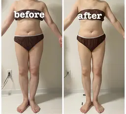 【痩身】【全身】最高級マシン!切らない脂肪吸引!ZERO CRASH