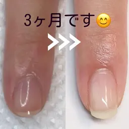 急募☆自爪育成モデル募集♪初回育成オイル込み/２回目以降¥6,600/✨☺️