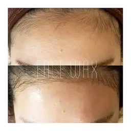 初回>>【お顔の産毛脱毛】フェイシャルワックス脱毛【ツルツル美肌】