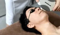 【メンズ脱毛】ヒゲ全体