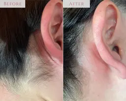 4/15空き◎【新生活応援セール❤️🔥】うなじ&もみあげ美設計デザインWax✨ すっきり清潔感×美人度UP💖