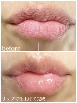 唇ケアパック&マッサージ