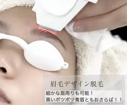 【最新】　大人気！　~眉毛デザイン光脱毛~