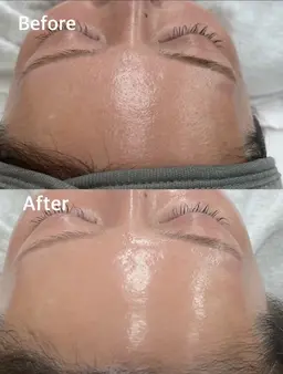 【韓国で人気!】剥離なしララピール★うる艶美白美肌Get↑60分¥13800→¥8800