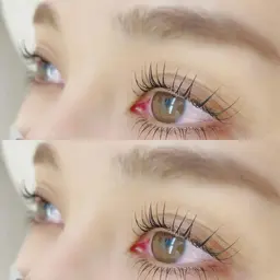 【 中顔面短縮🎀 】上下ラッシュリフト（ 土日祝＋550円 ）