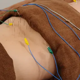 ⚠️期間限定[💥腰痛、背中のコリに]🍀全身鍼＋パルス＋マッサージ 90分