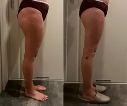 究極の脚痩せ🦵✨✨ヒップアップ⤴️脚長効果